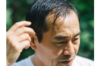 九游会j9官方登录植发第一股雍禾医疗暴跌